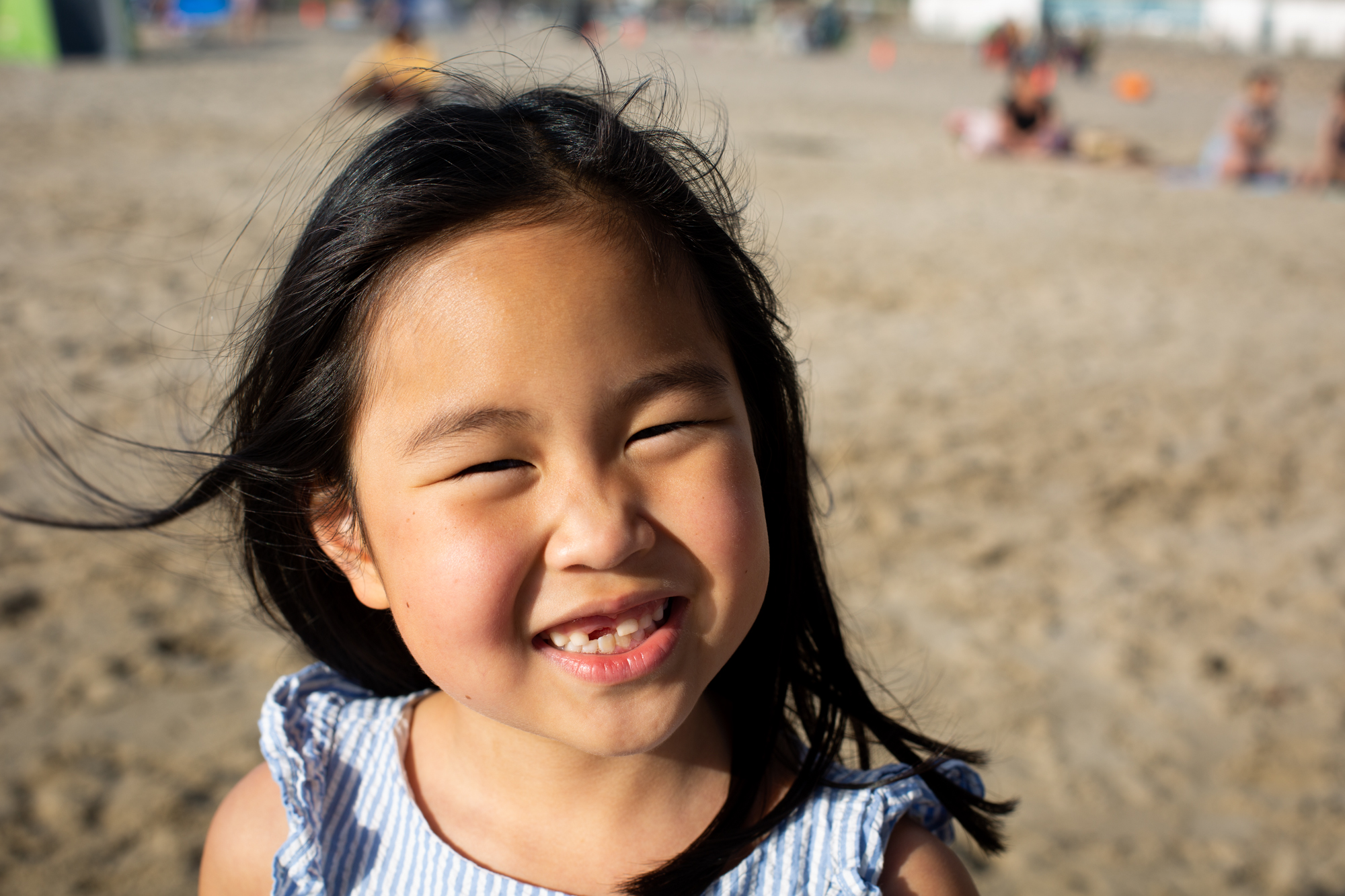Los Angeles girl at beach missing two front teeth